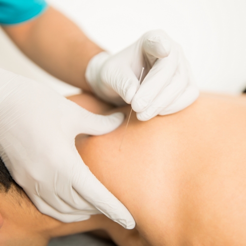 physical-therapy-clinic-dry-needling-bethesda-physical-therapy-bethesda-kensington-md