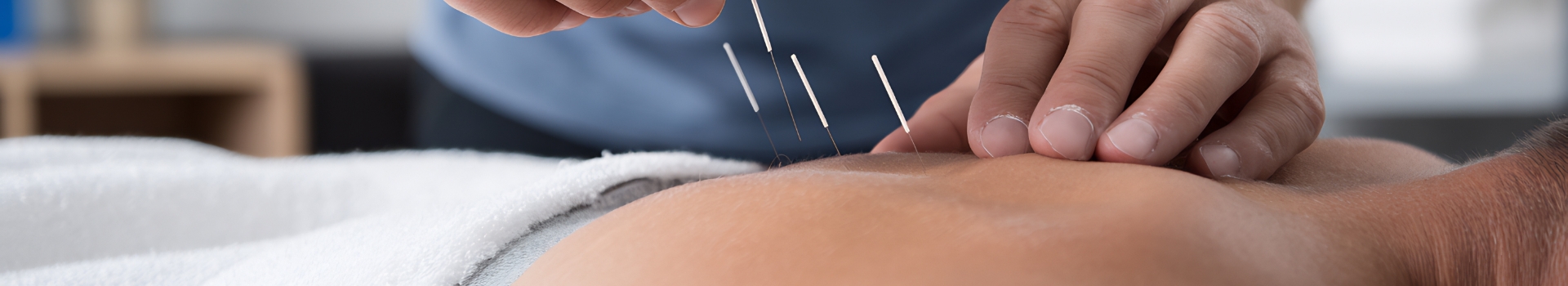 Dry Needling