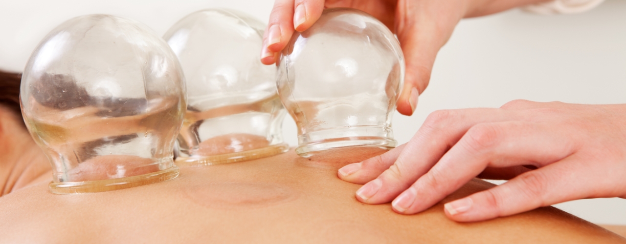 physical-therapy-clinic-cupping-main-street-physical-therapy-akron-oh