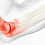 Alleviating Pain from Musculoskeletal Injuries with Physical Therapy