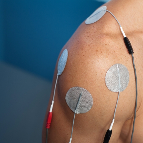 electrical-stimulation-physiosource-physical-therapy-toledo-oh