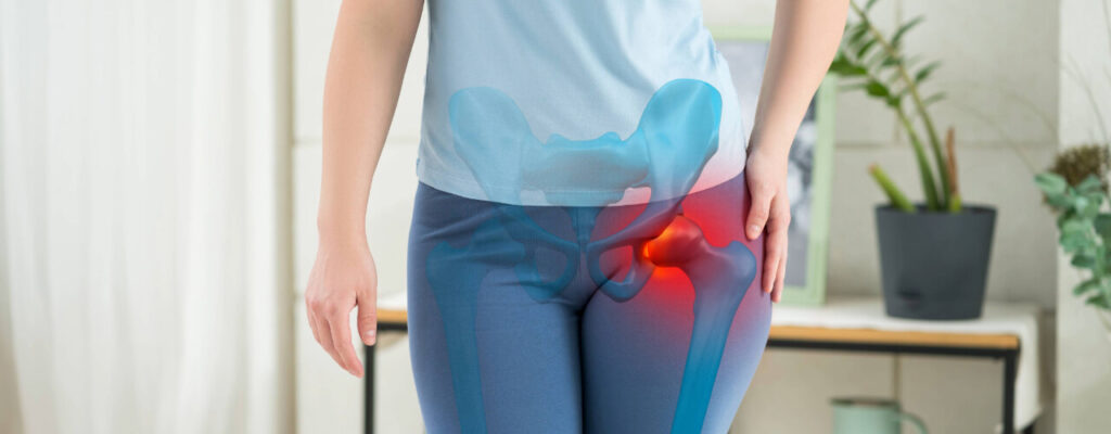 Physical Therapy Techniques for Hip Bursitis Relief