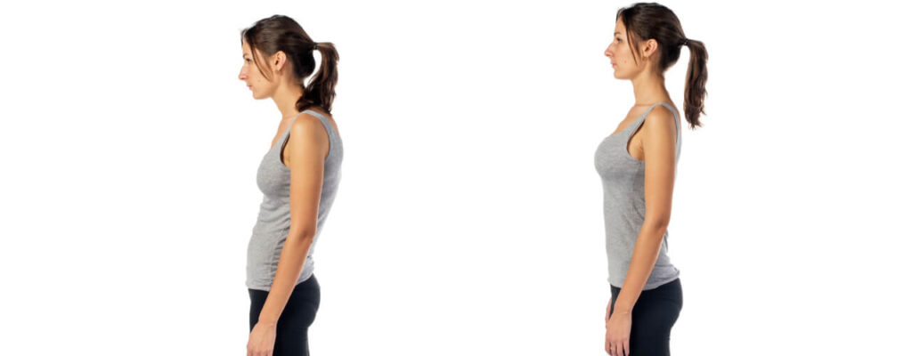 Postural dysfunction in Sternen Physical Therapy