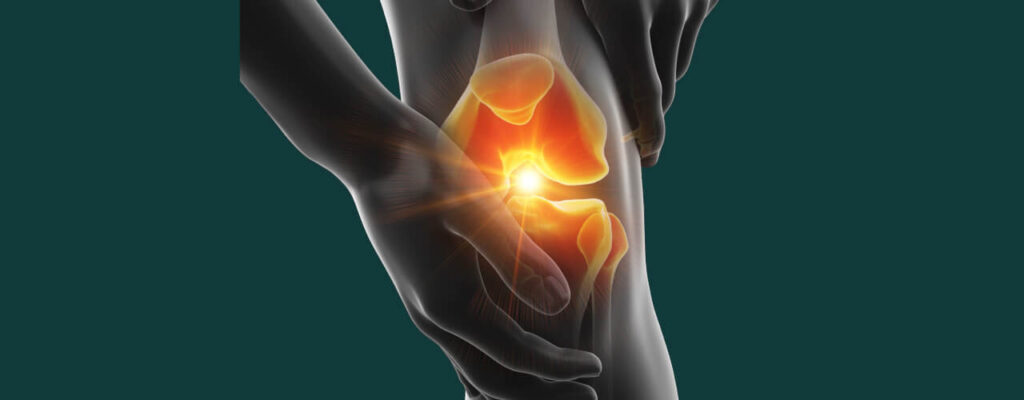 Regain Control: Physical Therapy for Optimal Knee Pain Management